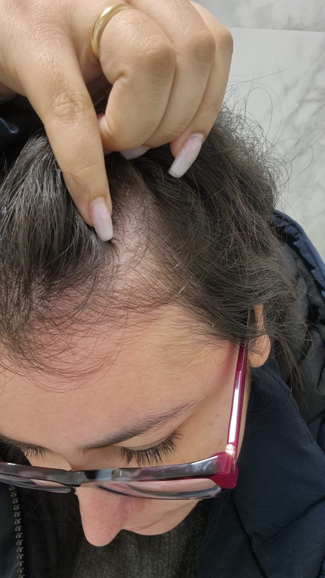 Antes e depois 1 — antes